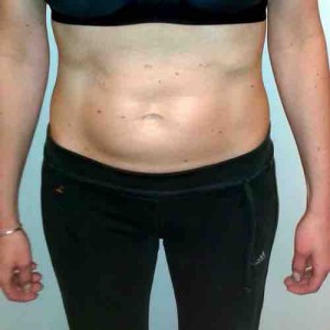 Sonja L. nach 3 Monaten HYPOXI | Sonja L. after 3 months with HYPOXI