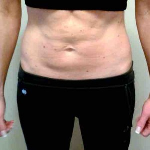 Sonja L. nach 4 Monaten HYPOXI | Sonja L. after 4 months with HYPOXI